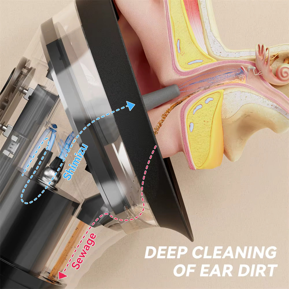 EarEase™ Voldic Ear Cleaning Kit